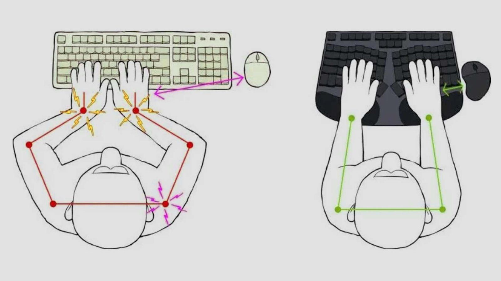Ergonomic Keyboards